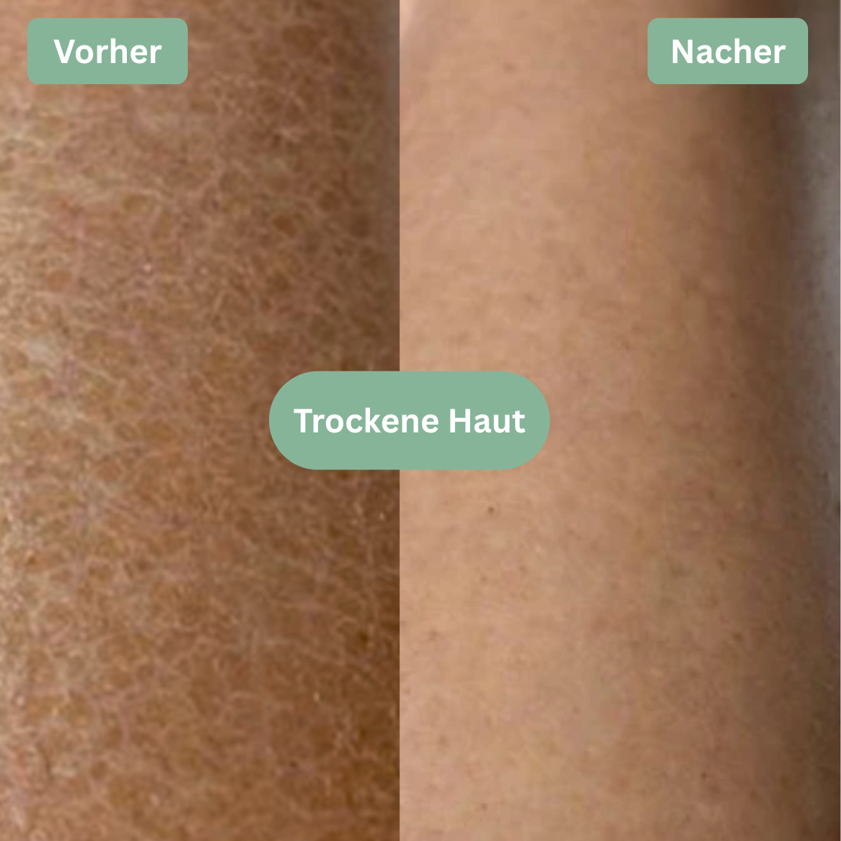 LOOMSKIN™ - Premium Hautpflegetuch