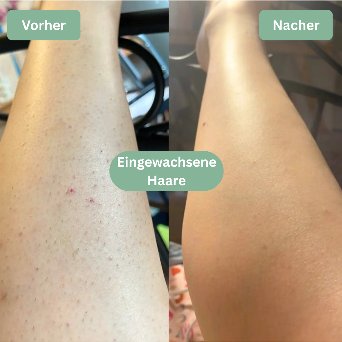 LOOMSKIN™ - Premium Hautpflegetuch