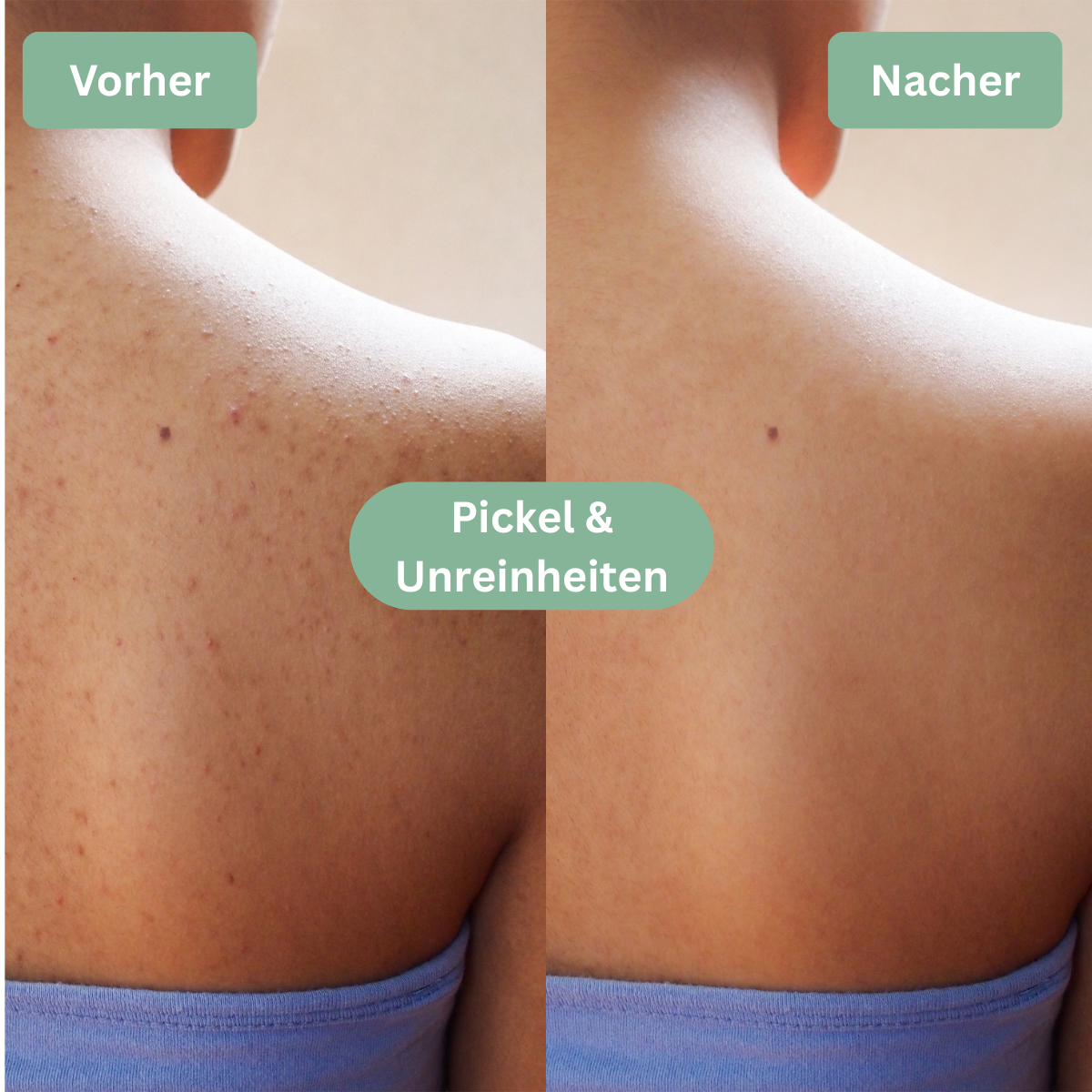 LOOMSKIN™ - Premium Hautpflegetuch