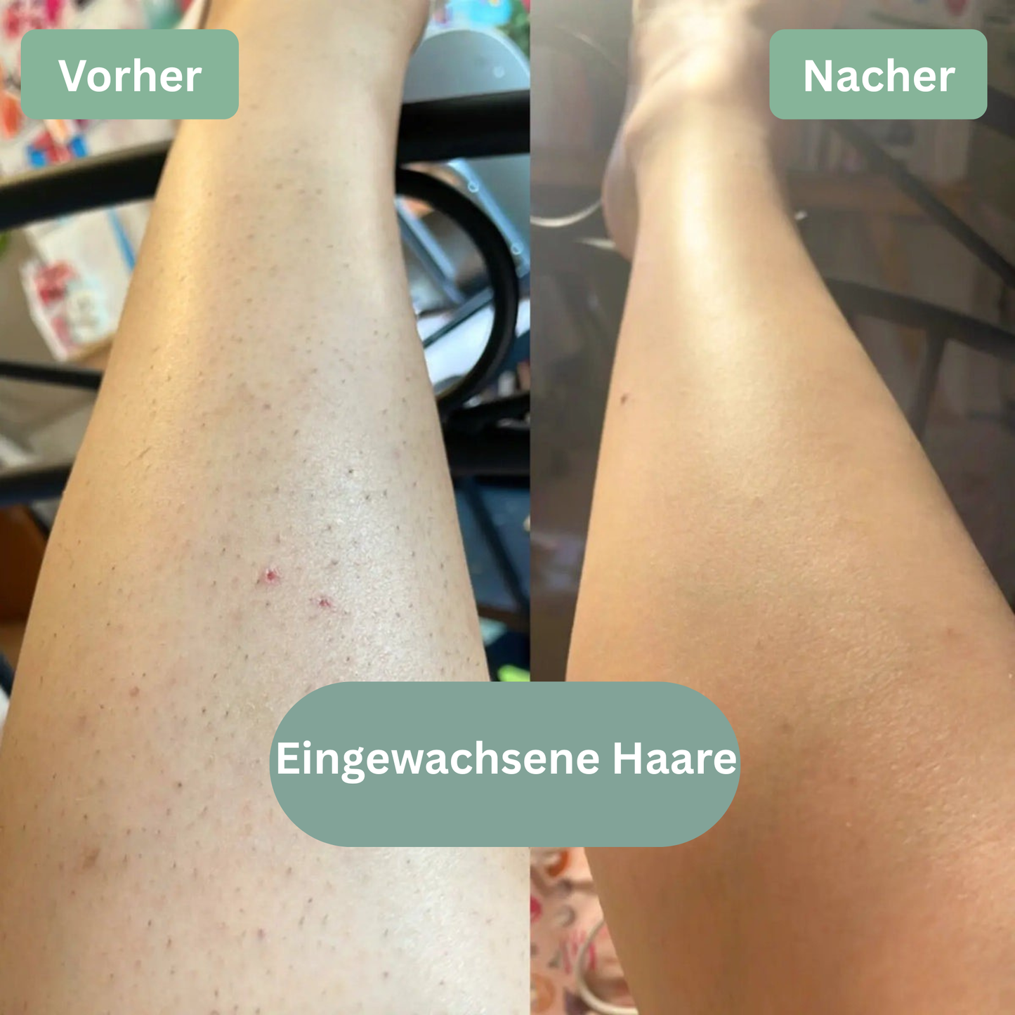 LOOMSKIN™ - Premium Hautpflegetuch